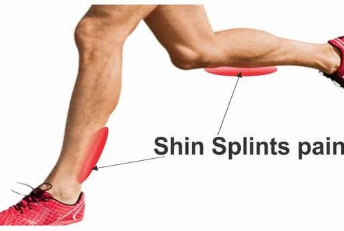 Painful Shins (Shin splints)