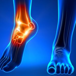 Trapped toe nerve