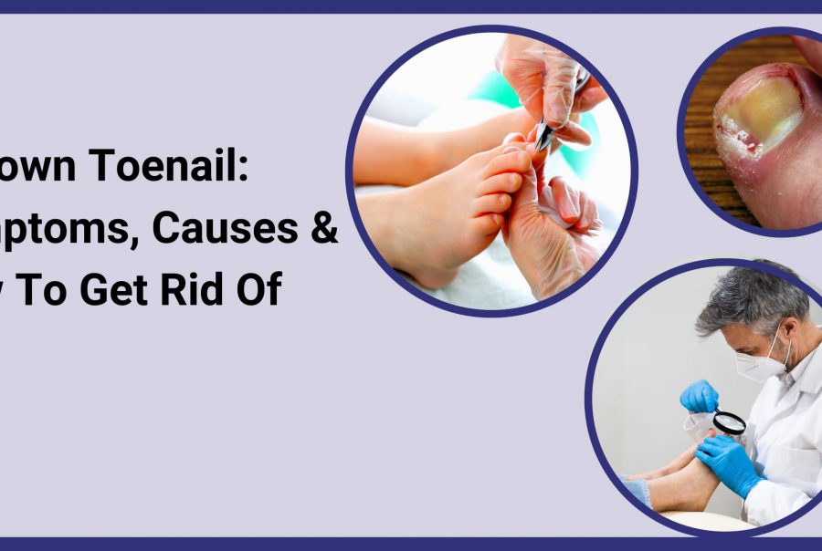 Ingrown toenails cure near me Professional Care Bucks Foot Clinic