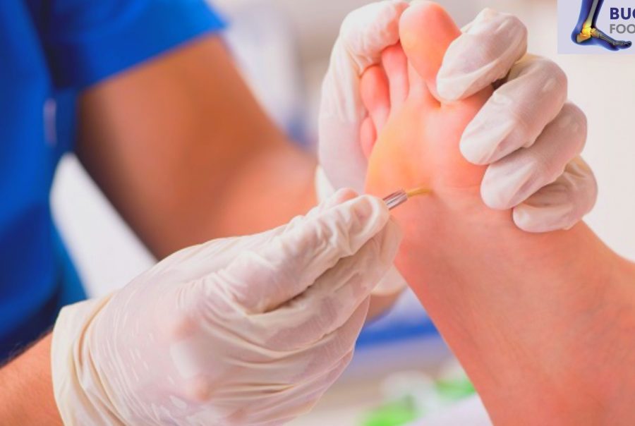 How to treat a corn Is a corn serious Bucks Foot Clinic