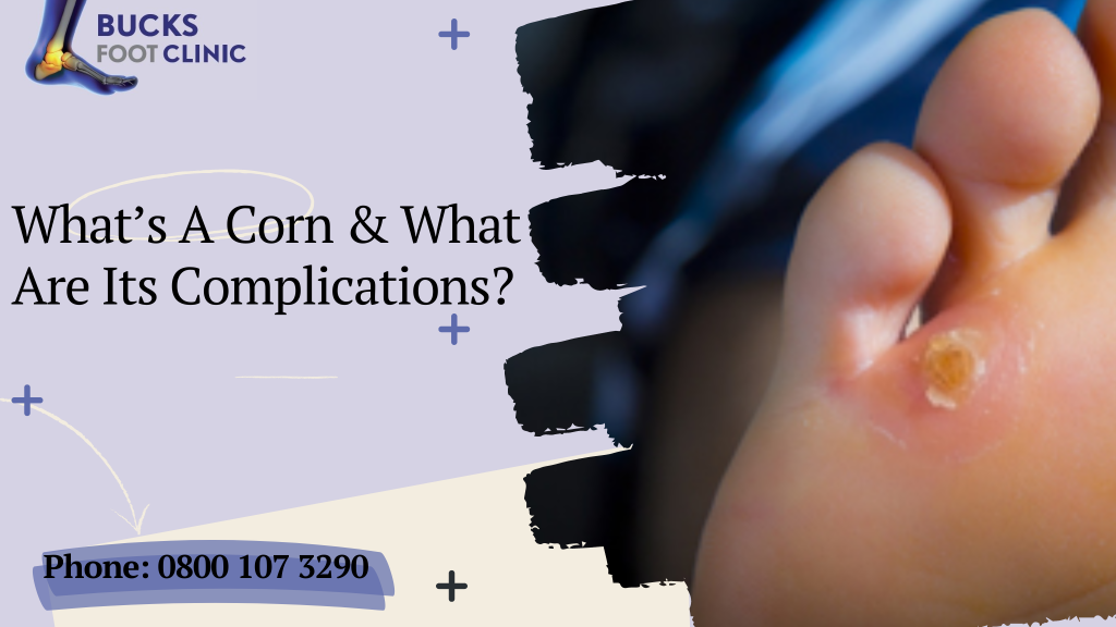 What’s A Corn & What Are Its Complications?