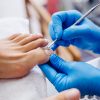 ingrown or fungal toenails