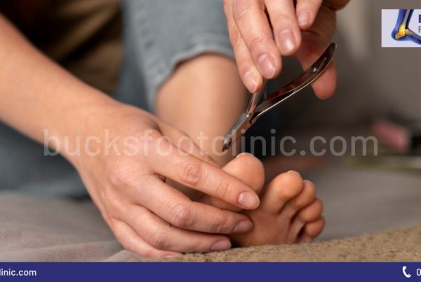 Ingrown Toenail Condition