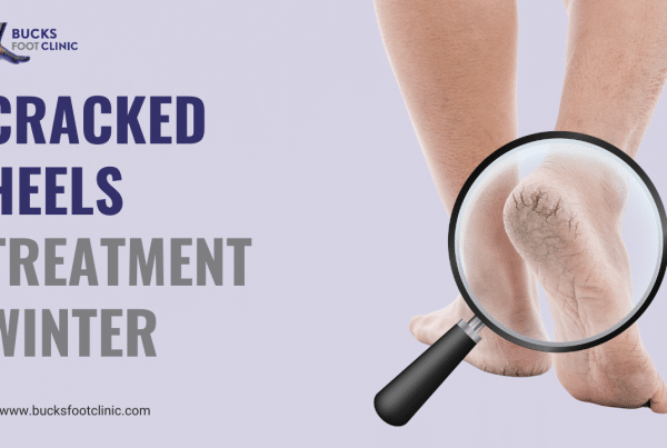 Cracked heels treatment winter