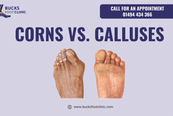 Corns vs. Calluses