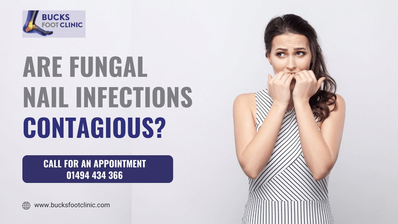 Fungal Nail Infections Contagious