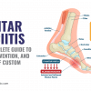 Plantar Fasciitis
