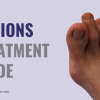 bunions treatment guide