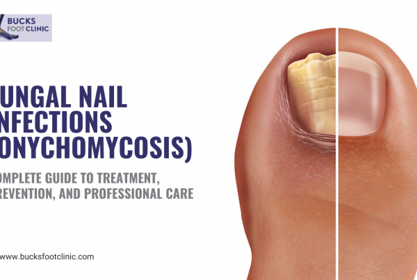 Fungal Nail Infections