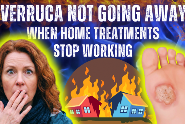 verruca not going away