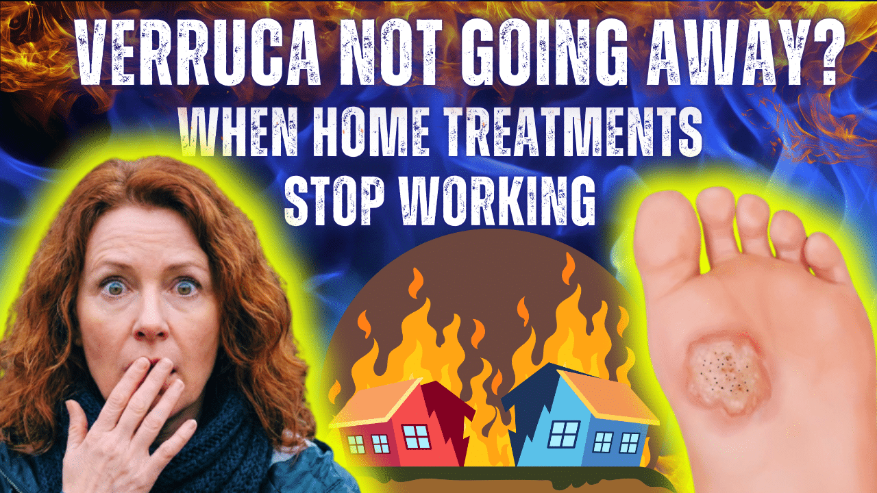 verruca not going away