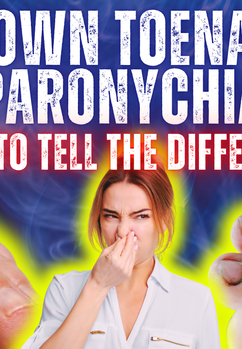 ingrown toenail vs paronychia