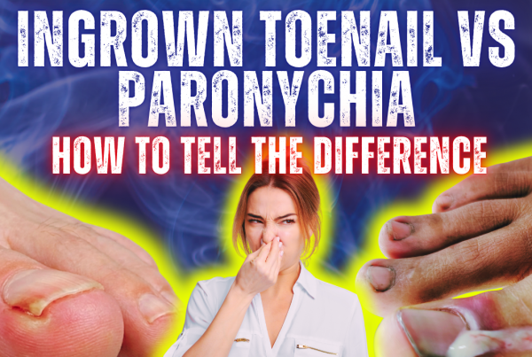ingrown toenail vs paronychia