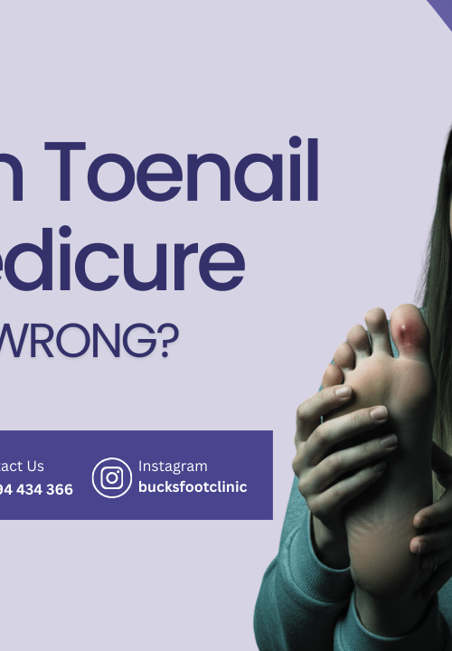 Ingrown toenail after pedicure