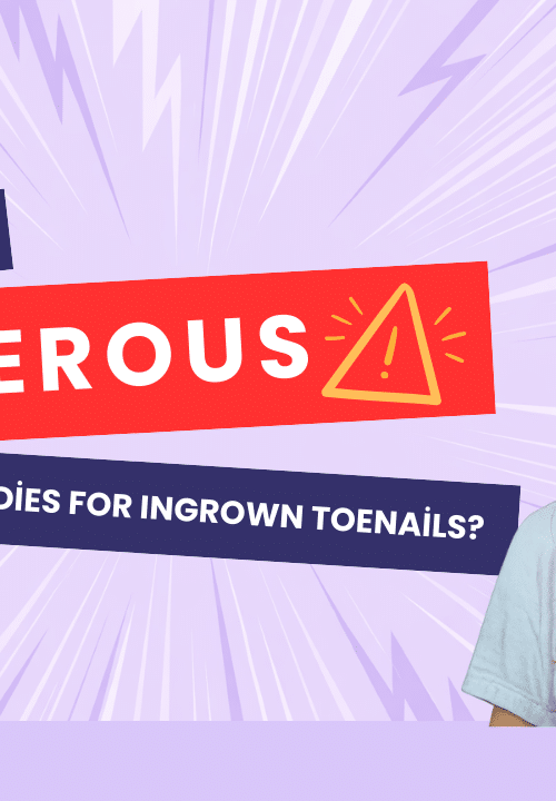 home remedies for ingrown toenails