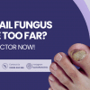 fungal toenail infection treatment