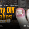 ingrown toenail treatment