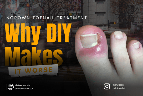 ingrown toenail treatment