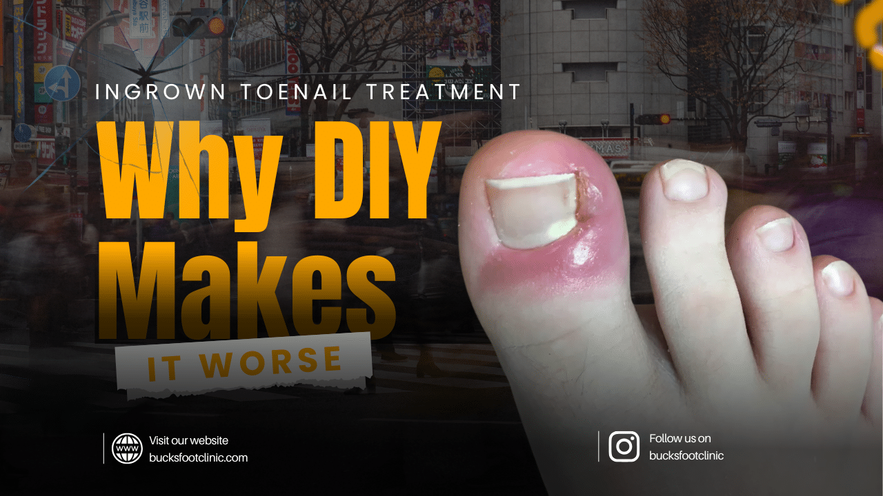 ingrown toenail treatment