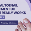 fungal toenail treatment
