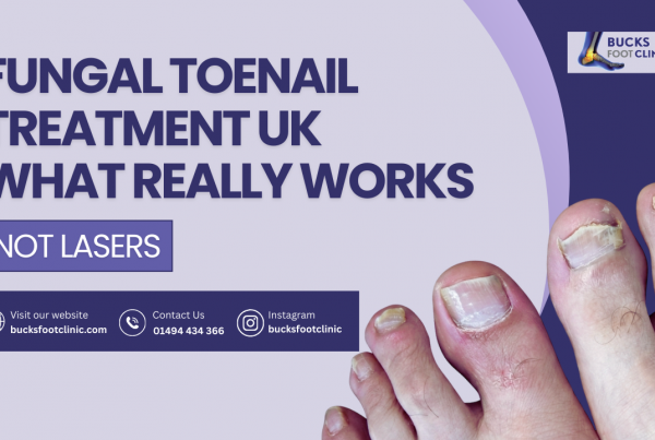 fungal toenail treatment