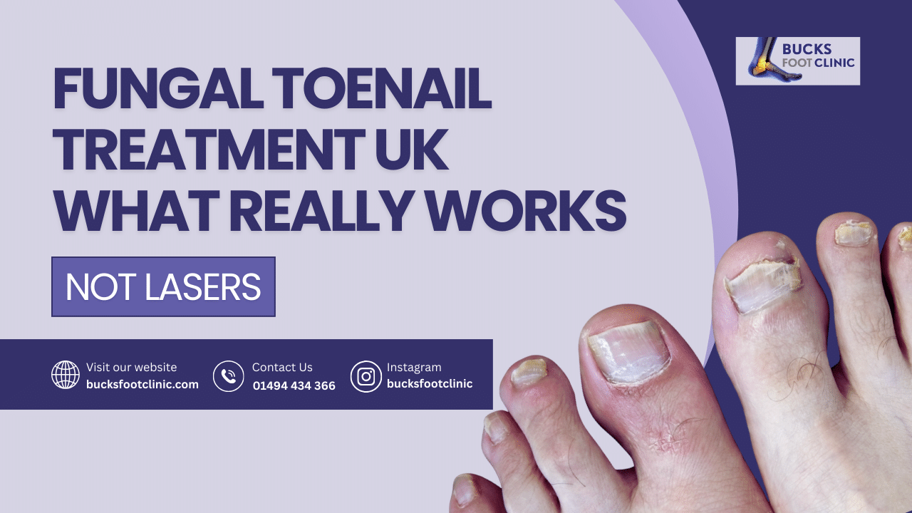 fungal toenail treatment