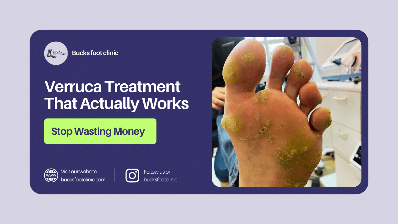 verruca treatment that works